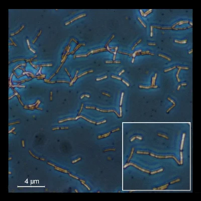 Lactobacillus acidophilus vu au microscope