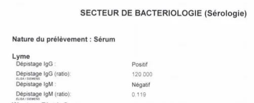 Extrait d'un résultat d'ELISA positif en IgG