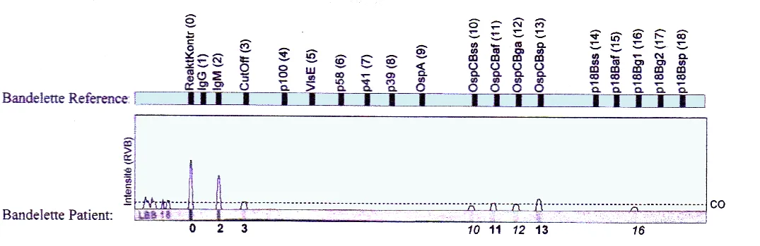 Western Blot avec cut off
